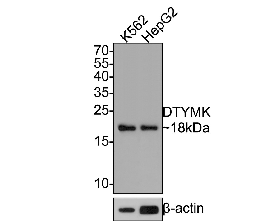 Western blot analysis of DTYMK on different lysates with Rabbit anti-DTYMK antibody (HA721116) at 1/500 dilution.<br />
<br />
Lane 1: K562 cell lysate<br />
Lane 2: HepG2 cell lysate<br />
<br />
Lysates/proteins at 10 µg/Lane.<br />
<br />
Predicted band size: 24 kDa<br />
Observed band size: 18 kDa<br />
<br />
Exposure time: 2 minutes;<br />
<br />
15% SDS-PAGE gel.<br />
<br />
Proteins were transferred to a PVDF membrane and blocked with 5% NFDM/TBST for 1 hour at room temperature. The primary antibody (HA721116) at 1/500 dilution was used in 5% NFDM/TBST at room temperature for 2 hours. Goat Anti-Rabbit IgG - HRP Secondary Antibody (HA1001) at 1:300,000 dilution was used for 1 hour at room temperature.