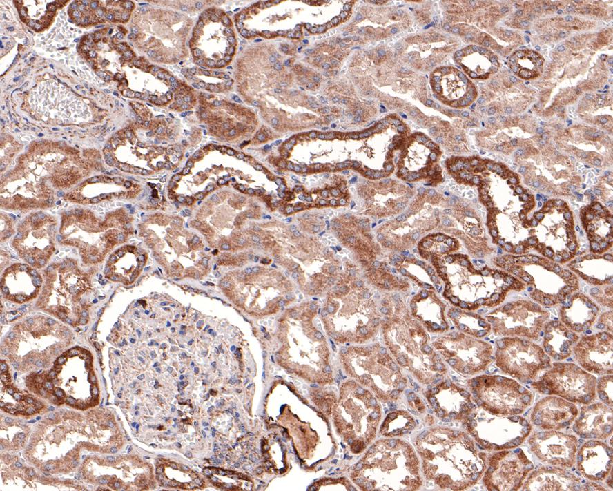 Immunohistochemical analysis of paraffin-embedded human kidney tissue with Rabbit anti-DTYMK antibody (HA721116) at 1/100 dilution.<br />
<br />
The section was pre-treated using heat mediated antigen retrieval with Tris-EDTA buffer (pH 9.0) for 20 minutes. The tissues were blocked in 1% BSA for 20 minutes at room temperature, washed with ddH2O and PBS, and then probed with the primary antibody (HA721116) at 1/100 dilution for 1 hour at room temperature. The detection was performed using an HRP conjugated compact polymer system. DAB was used as the chromogen. Tissues were counterstained with hematoxylin and mounted with DPX.
