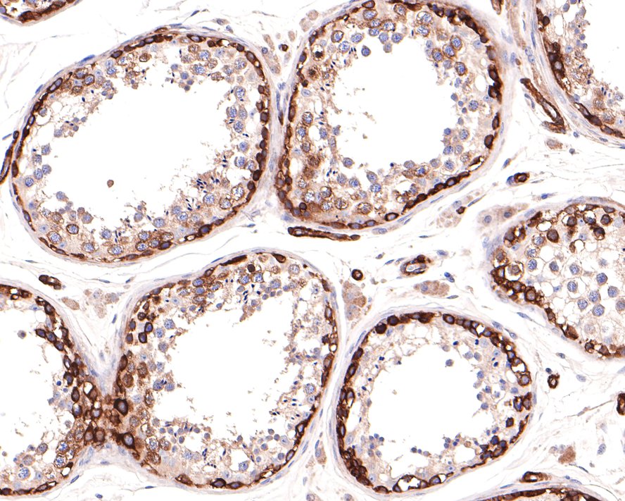 Immunohistochemical analysis of paraffin-embedded human testis tissue with Rabbit anti-MYO1B antibody (HA721119) at 1/400 dilution.<br />
<br />
The section was pre-treated using heat mediated antigen retrieval with Tris-EDTA buffer (pH 9.0) for 20 minutes. The tissues were blocked in 1% BSA for 20 minutes at room temperature, washed with ddH2O and PBS, and then probed with the primary antibody (HA721119) at 1/400 dilution for 1 hour at room temperature. The detection was performed using an HRP conjugated compact polymer system. DAB was used as the chromogen. Tissues were counterstained with hematoxylin and mounted with DPX.