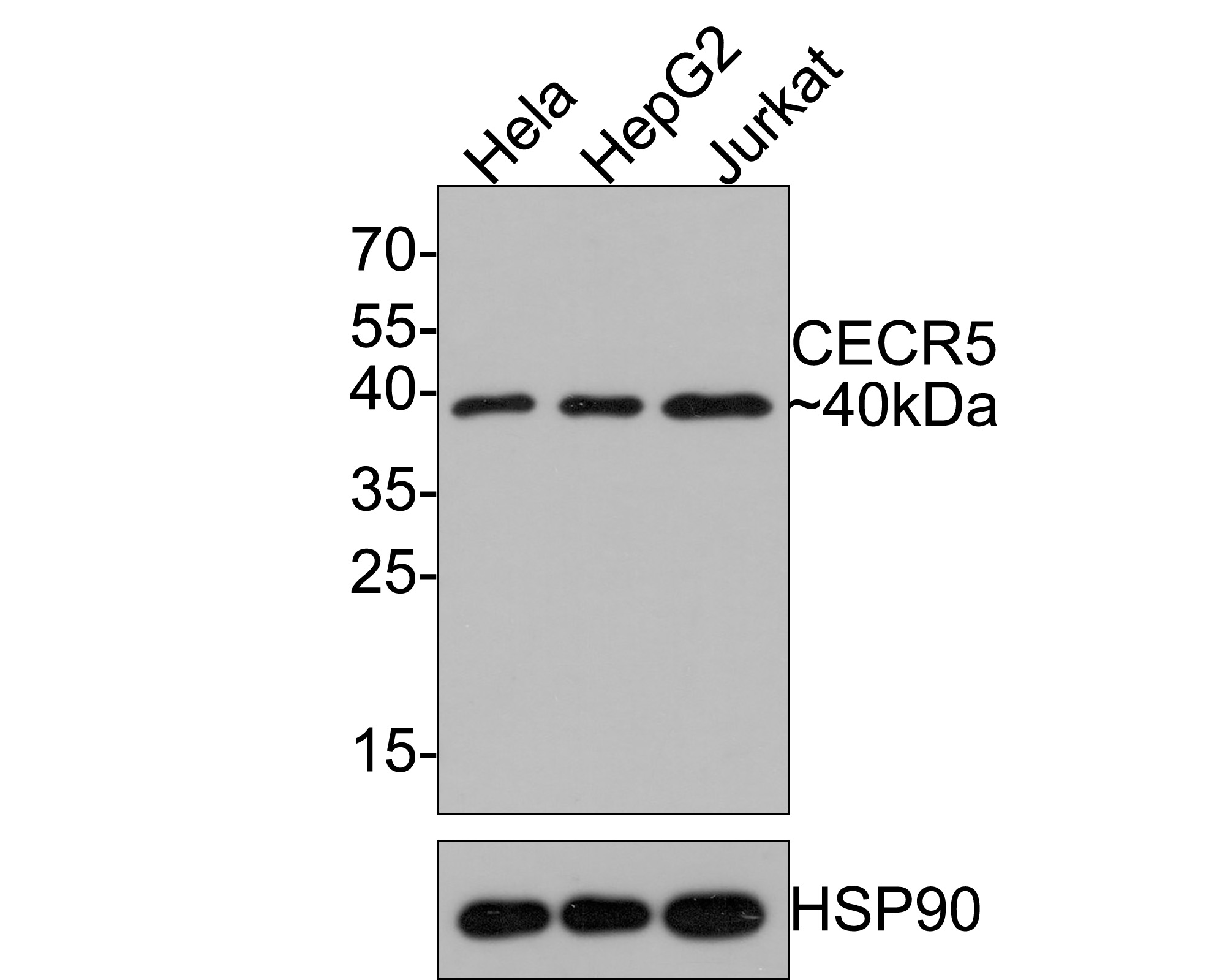Western blot analysis of CECR5 on different lysates with Rabbit anti-CECR5 antibody (HA721120) at 1/500 dilution.<br />
<br />
Lane 1: Hela cell lysate<br />
Lane 2: HepG2 cell lysate<br />
Lane 3: Jurkat cell lysate<br />
<br />
Lysates/proteins at 10 µg/Lane.<br />
<br />
Predicted band size: 46 kDa<br />
Observed band size: 40 kDa<br />
<br />
Exposure time: 2 minutes;<br />
<br />
12% SDS-PAGE gel.<br />
<br />
Proteins were transferred to a PVDF membrane and blocked with 5% NFDM/TBST for 1 hour at room temperature. The primary antibody (HA721120) at 1/500 dilution was used in 5% NFDM/TBST at room temperature for 2 hours. Goat Anti-Rabbit IgG - HRP Secondary Antibody (HA1001) at 1:300,000 dilution was used for 1 hour at room temperature.
