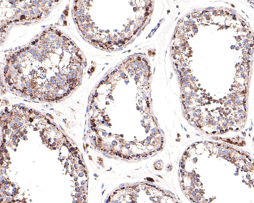 Immunohistochemical analysis of paraffin-embedded human testis tissue with Rabbit anti-CECR5 antibody (HA721120) at 1/100 dilution.<br />
<br />
The section was pre-treated using heat mediated antigen retrieval with Tris-EDTA buffer (pH 9.0) for 20 minutes. The tissues were blocked in 1% BSA for 20 minutes at room temperature, washed with ddH2O and PBS, and then probed with the primary antibody (HA721120) at 1/100 dilution for 1 hour at room temperature. The detection was performed using an HRP conjugated compact polymer system. DAB was used as the chromogen. Tissues were counterstained with hematoxylin and mounted with DPX.