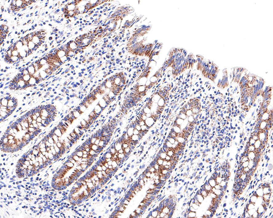 Immunohistochemical analysis of paraffin-embedded human colon tissue with Rabbit anti-CECR5 antibody (HA721120) at 1/100 dilution.<br />
<br />
The section was pre-treated using heat mediated antigen retrieval with Tris-EDTA buffer (pH 9.0) for 20 minutes. The tissues were blocked in 1% BSA for 20 minutes at room temperature, washed with ddH2O and PBS, and then probed with the primary antibody (HA721120) at 1/100 dilution for 1 hour at room temperature. The detection was performed using an HRP conjugated compact polymer system. DAB was used as the chromogen. Tissues were counterstained with hematoxylin and mounted with DPX.