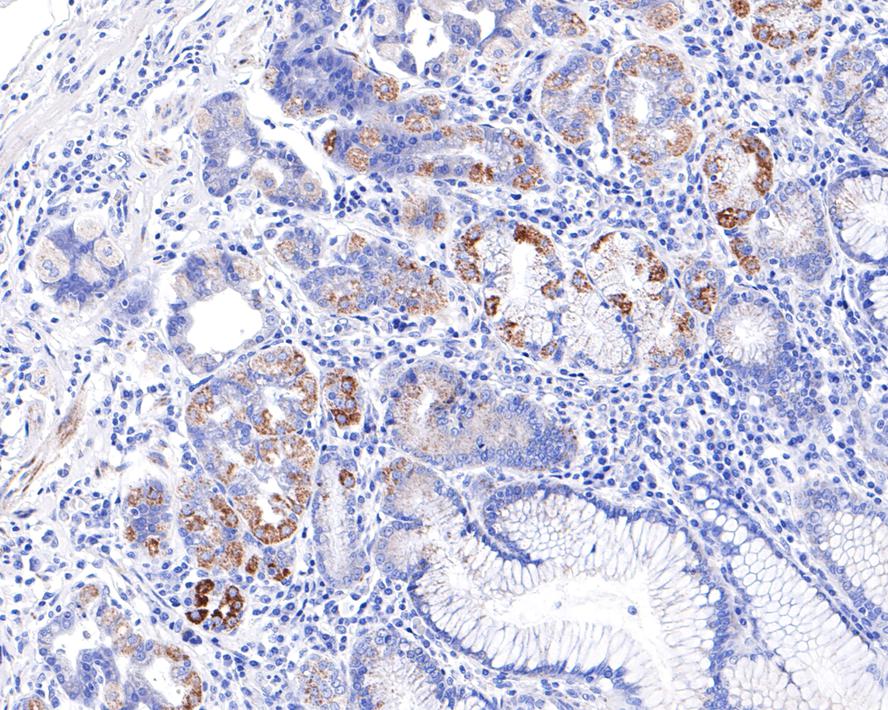 Immunohistochemical analysis of paraffin-embedded human stomach tissue with Rabbit anti-CECR5 antibody (HA721120) at 1/100 dilution.<br />
<br />
The section was pre-treated using heat mediated antigen retrieval with Tris-EDTA buffer (pH 9.0) for 20 minutes. The tissues were blocked in 1% BSA for 20 minutes at room temperature, washed with ddH2O and PBS, and then probed with the primary antibody (HA721120) at 1/100 dilution for 1 hour at room temperature. The detection was performed using an HRP conjugated compact polymer system. DAB was used as the chromogen. Tissues were counterstained with hematoxylin and mounted with DPX.