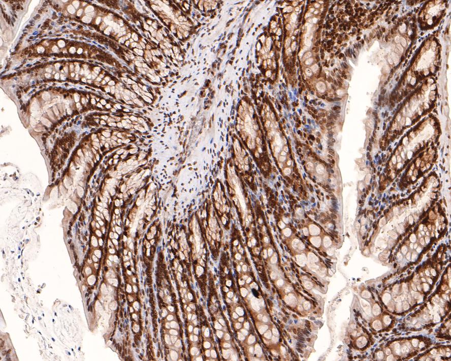 Immunohistochemical analysis of paraffin-embedded rat large intestine tissue with Rabbit anti-PIN4 antibody (HA721121) at 1/2,000 dilution.<br />
<br />
The section was pre-treated using heat mediated antigen retrieval with sodium citrate buffer (pH 6.0) for 2 minutes. The tissues were blocked in 1% BSA for 20 minutes at room temperature, washed with ddH2O and PBS, and then probed with the primary antibody (HA721121) at 1/2,000 dilution for 1 hour at room temperature. The detection was performed using an HRP conjugated compact polymer system. DAB was used as the chromogen. Tissues were counterstained with hematoxylin and mounted with DPX.
