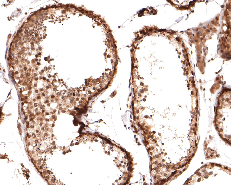 Immunohistochemical analysis of paraffin-embedded human testis tissue with Rabbit anti-PIN4 antibody (HA721121) at 1/2,000 dilution.<br />
<br />
The section was pre-treated using heat mediated antigen retrieval with sodium citrate buffer (pH 6.0) for 2 minutes. The tissues were blocked in 1% BSA for 20 minutes at room temperature, washed with ddH2O and PBS, and then probed with the primary antibody (HA721121) at 1/2,000 dilution for 1 hour at room temperature. The detection was performed using an HRP conjugated compact polymer system. DAB was used as the chromogen. Tissues were counterstained with hematoxylin and mounted with DPX.