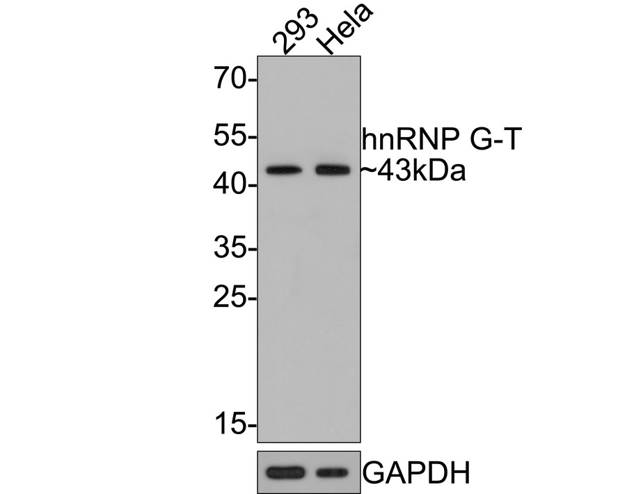 Western blot analysis of hnRNP G-T on different lysates with Rabbit anti-hnRNP G-T antibody (HA721104) at 1/5,000 dilution.<br />
<br />
Lane 1: 293 cell lysate<br />
Lane 2: Hela cell lysate<br />
<br />
Lysates/proteins at 10 µg/Lane.<br />
<br />
Predicted band size: 43 kDa<br />
Observed band size: 43 kDa<br />
<br />
Exposure time: 2 minutes;<br />
<br />
12% SDS-PAGE gel.<br />
<br />
Proteins were transferred to a PVDF membrane and blocked with 5% NFDM/TBST for 1 hour at room temperature. The primary antibody (HA721104) at 1/5,000 dilution was used in 5% NFDM/TBST at room temperature for 2 hours. Goat Anti-Rabbit IgG - HRP Secondary Antibody (HA1001) at 1:300,000 dilution was used for 1 hour at room temperature.