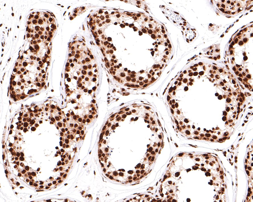 Immunohistochemical analysis of paraffin-embedded human testis tissue with Rabbit anti-hnRNP G-T antibody (HA721104) at 1/400 dilution.<br />
<br />
The section was pre-treated using heat mediated antigen retrieval with sodium citrate buffer (pH 6.0) for 2 minutes. The tissues were blocked in 1% BSA for 20 minutes at room temperature, washed with ddH2O and PBS, and then probed with the primary antibody (HA721104) at 1/400 dilution for 1 hour at room temperature. The detection was performed using an HRP conjugated compact polymer system. DAB was used as the chromogen. Tissues were counterstained with hematoxylin and mounted with DPX.