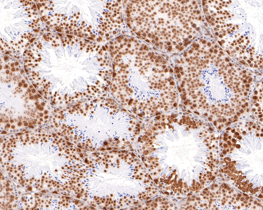 Immunohistochemical analysis of paraffin-embedded mouse testis tissue with Rabbit anti-hnRNP G-T antibody (HA721104) at 1/400 dilution.<br />
<br />
The section was pre-treated using heat mediated antigen retrieval with sodium citrate buffer (pH 6.0) for 2 minutes. The tissues were blocked in 1% BSA for 20 minutes at room temperature, washed with ddH2O and PBS, and then probed with the primary antibody (HA721104) at 1/400 dilution for 1 hour at room temperature. The detection was performed using an HRP conjugated compact polymer system. DAB was used as the chromogen. Tissues were counterstained with hematoxylin and mounted with DPX.