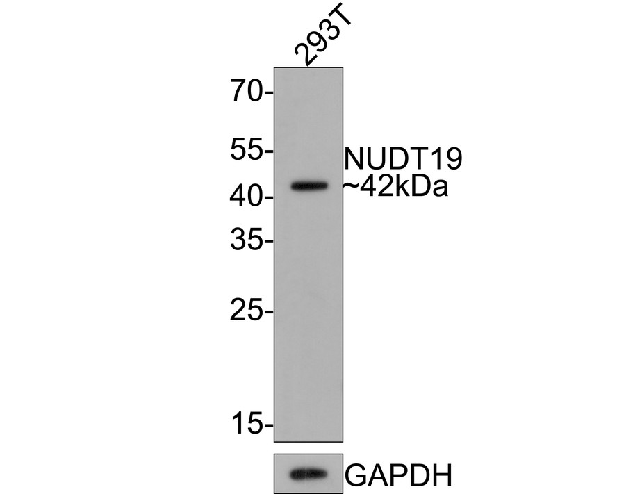 Western blot analysis of NUDT19 on 293T cell lysates with Rabbit anti-NUDT19 antibody (HA721101) at 1/500 dilution.<br />
<br />
Lysates/proteins at 10 µg/Lane.<br />
<br />
Predicted band size: 42 kDa<br />
Observed band size: 42 kDa<br />
<br />
Exposure time: 2 minutes;<br />
<br />
12% SDS-PAGE gel.<br />
<br />
Proteins were transferred to a PVDF membrane and blocked with 5% NFDM/TBST for 1 hour at room temperature. The primary antibody (HA721101) at 1/500 dilution was used in 5% NFDM/TBST at room temperature for 2 hours. Goat Anti-Rabbit IgG - HRP Secondary Antibody (HA1001) at 1:200,000 dilution was used for 1 hour at room temperature.