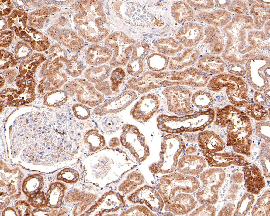 Immunohistochemical analysis of paraffin-embedded human kidney tissue with Rabbit anti-NUDT19 antibody (HA721101) at 1/100 dilution.<br />
<br />
The section was pre-treated using heat mediated antigen retrieval with Tris-EDTA buffer (pH 9.0) for 20 minutes. The tissues were blocked in 1% BSA for 20 minutes at room temperature, washed with ddH2O and PBS, and then probed with the primary antibody (HA721101) at 1/100 dilution for 1 hour at room temperature. The detection was performed using an HRP conjugated compact polymer system. DAB was used as the chromogen. Tissues were counterstained with hematoxylin and mounted with DPX.