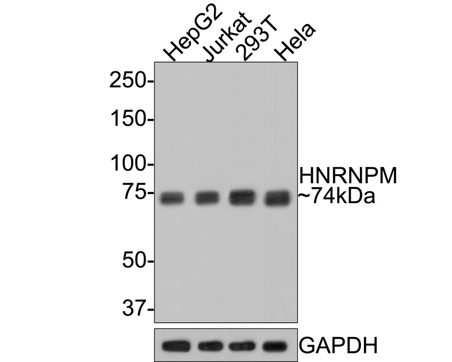 Western blot analysis of HNRNPM on different lysates with Rabbit anti-HNRNPM antibody (HA721103) at 1/1,000 dilution.<br />
<br />
Lane 1: HepG2 cell lysate<br />
Lane 2: Jurkat cell lysate<br />
Lane 3: 293T cell lysate<br />
Lane 4: Hela cell lysate<br />
<br />
Lysates/proteins at 10 µg/Lane.<br />
<br />
Predicted band size: 78 kDa<br />
Observed band size: 74 kDa<br />
<br />
Exposure time: 1 minute;<br />
<br />
8% SDS-PAGE gel.<br />
<br />
Proteins were transferred to a PVDF membrane and blocked with 5% NFDM/TBST for 1 hour at room temperature. The primary antibody (HA721103) at 1/1,000 dilution was used in 5% NFDM/TBST at room temperature for 2 hours. Goat Anti-Rabbit IgG - HRP Secondary Antibody (HA1001) at 1:300,000 dilution was used for 1 hour at room temperature.