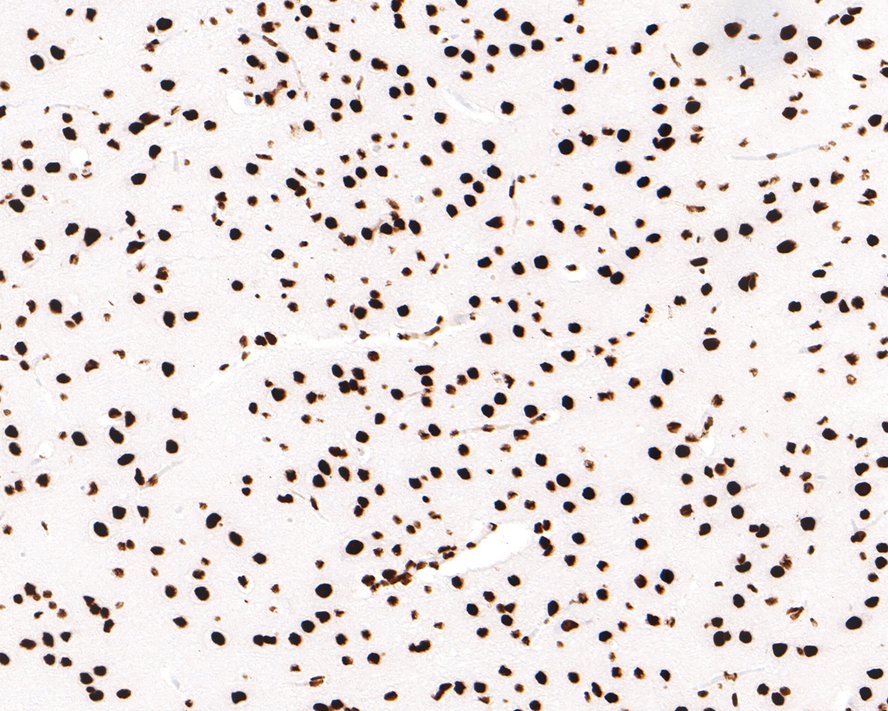 Immunohistochemical analysis of paraffin-embedded rat brain tissue with Rabbit anti-HNRNPM antibody (HA721103) at 1/400 dilution.<br />
<br />
The section was pre-treated using heat mediated antigen retrieval with sodium citrate buffer (pH 6.0) for 2 minutes. The tissues were blocked in 1% BSA for 20 minutes at room temperature, washed with ddH2O and PBS, and then probed with the primary antibody (HA721103) at 1/400 dilution for 1 hour at room temperature. The detection was performed using an HRP conjugated compact polymer system. DAB was used as the chromogen. Tissues were counterstained with hematoxylin and mounted with DPX.