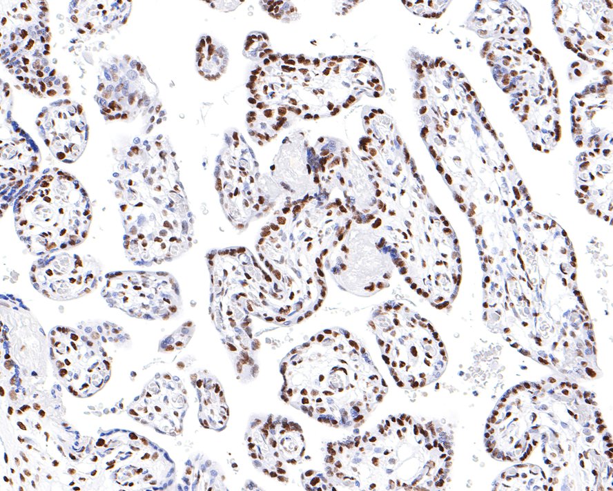 Immunohistochemical analysis of paraffin-embedded human placenta tissue with Rabbit anti-HNRNPM antibody (HA721103) at 1/200 dilution.<br />
<br />
The section was pre-treated using heat mediated antigen retrieval with sodium citrate buffer (pH 6.0) for 2 minutes. The tissues were blocked in 1% BSA for 20 minutes at room temperature, washed with ddH2O and PBS, and then probed with the primary antibody (HA721103) at 1/200 dilution for 1 hour at room temperature. The detection was performed using an HRP conjugated compact polymer system. DAB was used as the chromogen. Tissues were counterstained with hematoxylin and mounted with DPX.