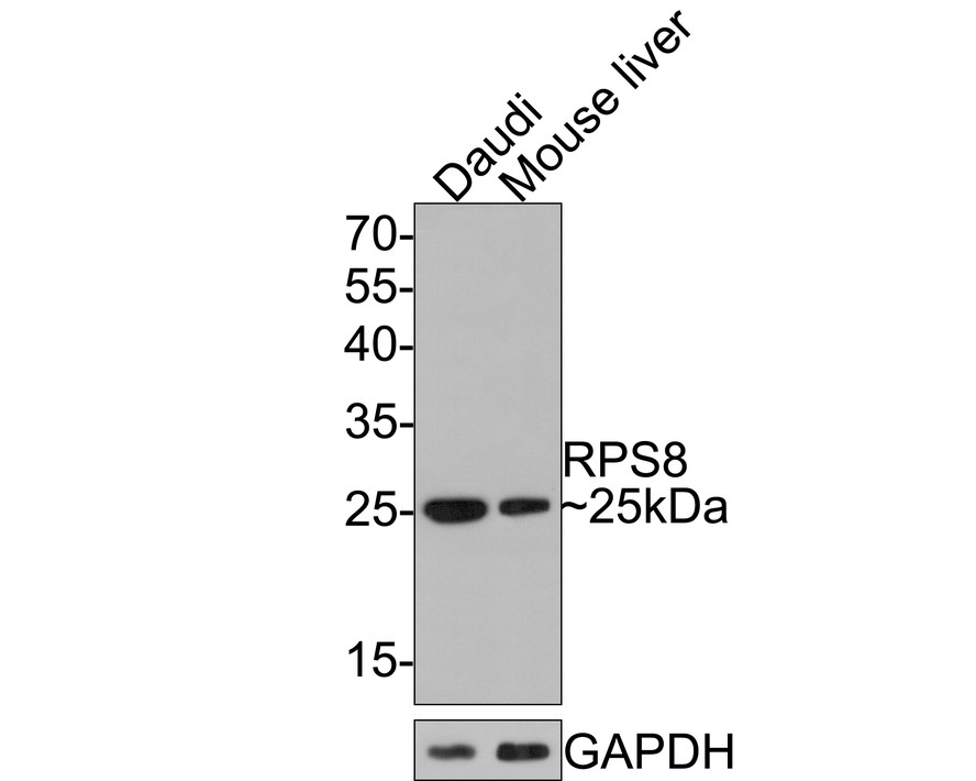 Western blot analysis of RPS8 on different lysates with Rabbit anti-RPS8 antibody (HA721105) at 1/500 dilution.<br />
<br />
Lane 1: Daudi cell lysate, 10 µg/Lane<br />
Lane 2: Mouse liver tissue lysate, 20 µg/Lane<br />
<br />
Predicted band size: 24 kDa<br />
Observed band size: 25 kDa<br />
<br />
Exposure time: 2 minutes;<br />
<br />
12% SDS-PAGE gel.<br />
<br />
Proteins were transferred to a PVDF membrane and blocked with 5% NFDM/TBST for 1 hour at room temperature. The primary antibody (HA721105) at 1/500 dilution was used in 5% NFDM/TBST at room temperature for 2 hours. Goat Anti-Rabbit IgG - HRP Secondary Antibody (HA1001) at 1:300,000 dilution was used for 1 hour at room temperature.