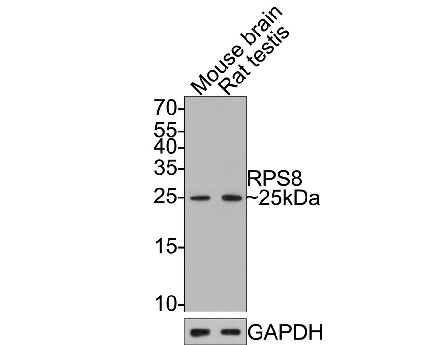Western blot analysis of RPS8 on different lysates with Rabbit anti-RPS8 antibody (HA721105) at 1/1,000 dilution.<br />
<br />
Lane 1: Mouse brain tissue lysate<br />
Lane 2: Rat testis tissue lysate<br />
<br />
Lysates/proteins at 20 µg/Lane.<br />
<br />
Predicted band size: 24 kDa<br />
Observed band size: 25 kDa<br />
<br />
Exposure time: 2 minutes;<br />
<br />
15% SDS-PAGE gel.<br />
<br />
Proteins were transferred to a PVDF membrane and blocked with 5% NFDM/TBST for 1 hour at room temperature. The primary antibody (HA721105) at 1/1,000 dilution was used in 5% NFDM/TBST at room temperature for 2 hours. Goat Anti-Rabbit IgG - HRP Secondary Antibody (HA1001) at 1:300,000 dilution was used for 1 hour at room temperature.