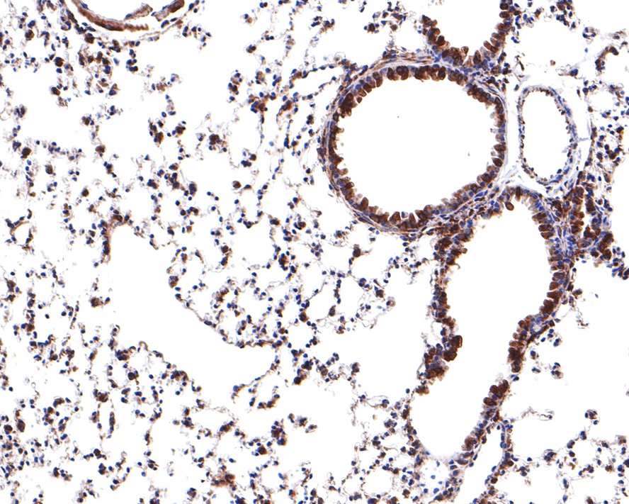 Immunohistochemical analysis of paraffin-embedded mouse lung tissue with Rabbit anti-RPS8 antibody (HA721105) at 1/400 dilution.<br />
<br />
The section was pre-treated using heat mediated antigen retrieval with Tris-EDTA buffer (pH 9.0) for 20 minutes. The tissues were blocked in 1% BSA for 20 minutes at room temperature, washed with ddH2O and PBS, and then probed with the primary antibody (HA721105) at 1/400 dilution for 1 hour at room temperature. The detection was performed using an HRP conjugated compact polymer system. DAB was used as the chromogen. Tissues were counterstained with hematoxylin and mounted with DPX.