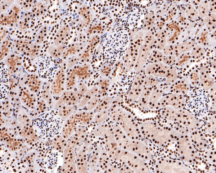 Immunohistochemical analysis of paraffin-embedded rat kidney tissue with Rabbit anti-SF3A3 antibody (HA721114) at 1/400 dilution.<br />
<br />
The section was pre-treated using heat mediated antigen retrieval with sodium citrate buffer (pH 6.0) for 2 minutes. The tissues were blocked in 1% BSA for 20 minutes at room temperature, washed with ddH2O and PBS, and then probed with the primary antibody (HA721114) at 1/400 dilution for 1 hour at room temperature. The detection was performed using an HRP conjugated compact polymer system. DAB was used as the chromogen. Tissues were counterstained with hematoxylin and mounted with DPX.