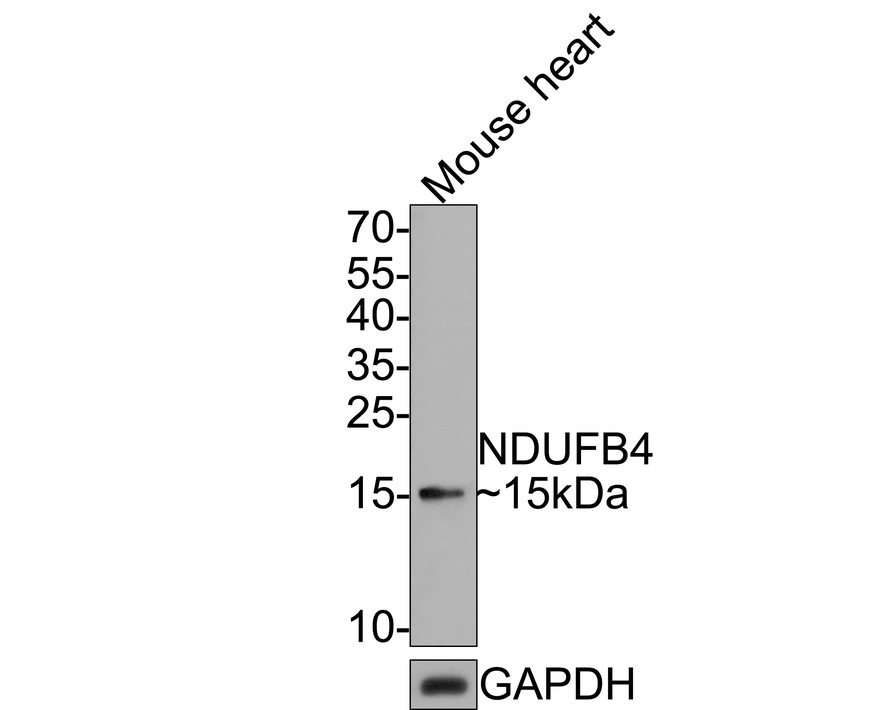 Western blot analysis of NDUFB4 on mouse heart tissue lysates with Rabbit anti-NDUFB4 antibody (HA721112) at 1/500 dilution.<br />
<br />
Lysates/proteins at 20 µg/Lane.<br />
<br />
Predicted band size: 15 kDa<br />
Observed band size: 15 kDa<br />
<br />
Exposure time: 2 minutes;<br />
<br />
15% SDS-PAGE gel.<br />
<br />
Proteins were transferred to a PVDF membrane and blocked with 5% NFDM/TBST for 1 hour at room temperature. The primary antibody (HA721112) at 1/500 dilution was used in 5% NFDM/TBST at room temperature for 2 hours. Goat Anti-Rabbit IgG - HRP Secondary Antibody (HA1001) at 1:300,000 dilution was used for 1 hour at room temperature.