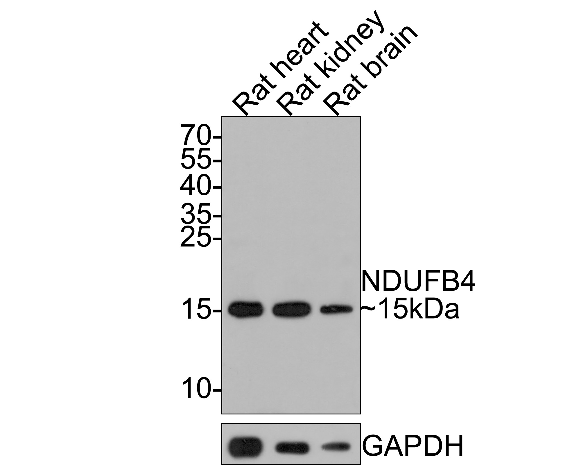 Western blot analysis of NDUFB4 on different lysates with Rabbit anti-NDUFB4 antibody (HA721112) at 1/500 dilution.<br />
<br />
Lane 1: Rat heart tissue lysate<br />
Lane 2: Rat kidney tissue lysate<br />
Lane 3: Rat brain tissue lysate<br />
<br />
Lysates/proteins at 20 µg/Lane.<br />
<br />
Predicted band size: 15 kDa<br />
Observed band size: 15 kDa<br />
<br />
Exposure time: 2 minutes;<br />
<br />
15% SDS-PAGE gel.<br />
<br />
Proteins were transferred to a PVDF membrane and blocked with 5% NFDM/TBST for 1 hour at room temperature. The primary antibody (HA721112) at 1/500 dilution was used in 5% NFDM/TBST at room temperature for 2 hours. Goat Anti-Rabbit IgG - HRP Secondary Antibody (HA1001) at 1:300,000 dilution was used for 1 hour at room temperature.