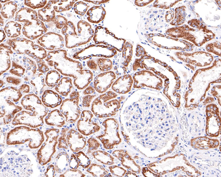 Immunohistochemical analysis of paraffin-embedded human kidney tissue with Rabbit anti-NDUFB4 antibody (HA721112) at 1/400 dilution.<br />
<br />
The section was pre-treated using heat mediated antigen retrieval with Tris-EDTA buffer (pH 9.0) for 20 minutes. The tissues were blocked in 1% BSA for 20 minutes at room temperature, washed with ddH2O and PBS, and then probed with the primary antibody (HA721112) at 1/400 dilution for 1 hour at room temperature. The detection was performed using an HRP conjugated compact polymer system. DAB was used as the chromogen. Tissues were counterstained with hematoxylin and mounted with DPX.
