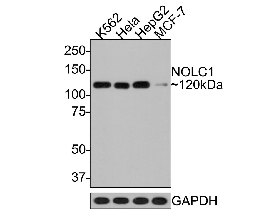 Western blot analysis of NOLC1 on different lysates with Rabbit anti-NOLC1 antibody (HA721113) at 1/500 dilution.<br />
<br />
Lane 1: K562 cell lysate<br />
Lane 2: Hela cell lysate<br />
Lane 3: HepG2 cell lysate<br />
Lane 4: MCF-7 cell lysate<br />
<br />
Lysates/proteins at 10 µg/Lane.<br />
<br />
Predicted band size: 74 kDa<br />
Observed band size: 120 kDa<br />
<br />
Exposure time: 30 seconds;<br />
<br />
8% SDS-PAGE gel.<br />
<br />
Proteins were transferred to a PVDF membrane and blocked with 5% NFDM/TBST for 1 hour at room temperature. The primary antibody (HA721113) at 1/500 dilution was used in 5% NFDM/TBST at room temperature for 2 hours. Goat Anti-Rabbit IgG - HRP Secondary Antibody (HA1001) at 1:300,000 dilution was used for 1 hour at room temperature.