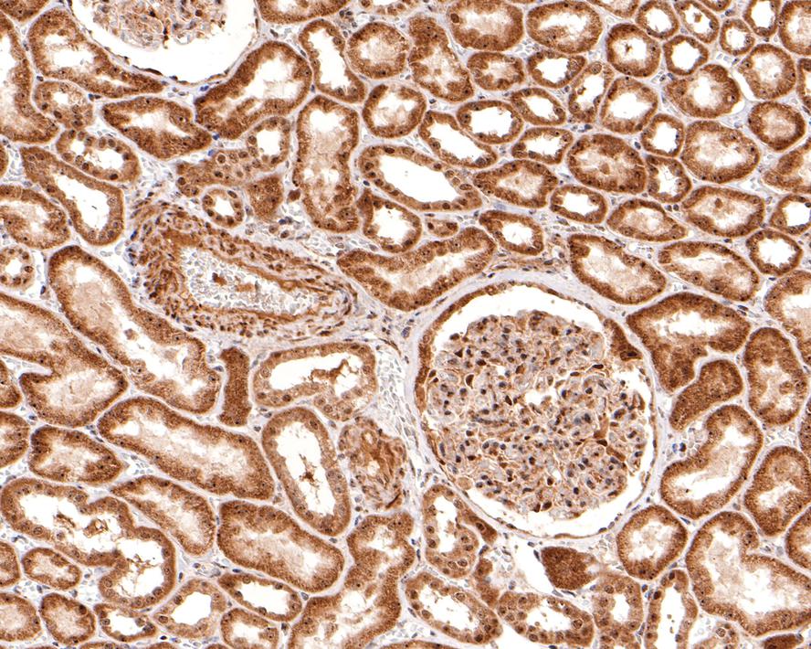 Immunohistochemical analysis of paraffin-embedded human kidney tissue with Rabbit anti-NOLC1 antibody (HA721113) at 1/400 dilution.<br />
<br />
The section was pre-treated using heat mediated antigen retrieval with sodium citrate buffer (pH 6.0) for 2 minutes. The tissues were blocked in 1% BSA for 20 minutes at room temperature, washed with ddH2O and PBS, and then probed with the primary antibody (HA721113) at 1/400 dilution for 1 hour at room temperature. The detection was performed using an HRP conjugated compact polymer system. DAB was used as the chromogen. Tissues were counterstained with hematoxylin and mounted with DPX.