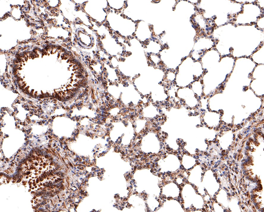 Immunohistochemical analysis of paraffin-embedded rat lung tissue with Rabbit anti-TMEM43 antibody (HA721083) at 1/100 dilution.<br />
<br />
The section was pre-treated using heat mediated antigen retrieval with sodium citrate buffer (pH 6.0) for 2 minutes. The tissues were blocked in 1% BSA for 20 minutes at room temperature, washed with ddH2O and PBS, and then probed with the primary antibody (HA721083) at 1/100 dilution for 1 hour at room temperature. The detection was performed using an HRP conjugated compact polymer system. DAB was used as the chromogen. Tissues were counterstained with hematoxylin and mounted with DPX.