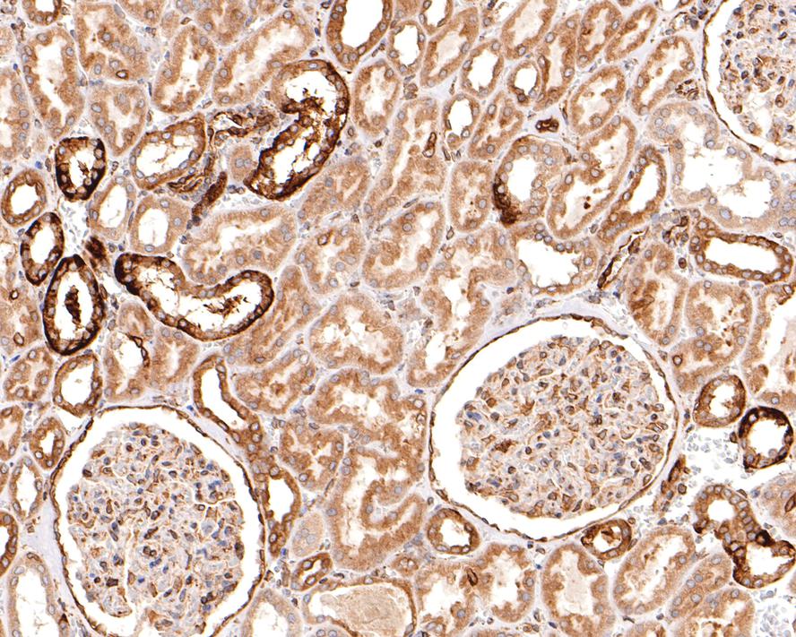Immunohistochemical analysis of paraffin-embedded human kidney tissue with Rabbit anti-TMEM43 antibody (HA721083) at 1/400 dilution.<br />
<br />
The section was pre-treated using heat mediated antigen retrieval with sodium citrate buffer (pH 6.0) for 2 minutes. The tissues were blocked in 1% BSA for 20 minutes at room temperature, washed with ddH2O and PBS, and then probed with the primary antibody (HA721083) at 1/400 dilution for 1 hour at room temperature. The detection was performed using an HRP conjugated compact polymer system. DAB was used as the chromogen. Tissues were counterstained with hematoxylin and mounted with DPX.