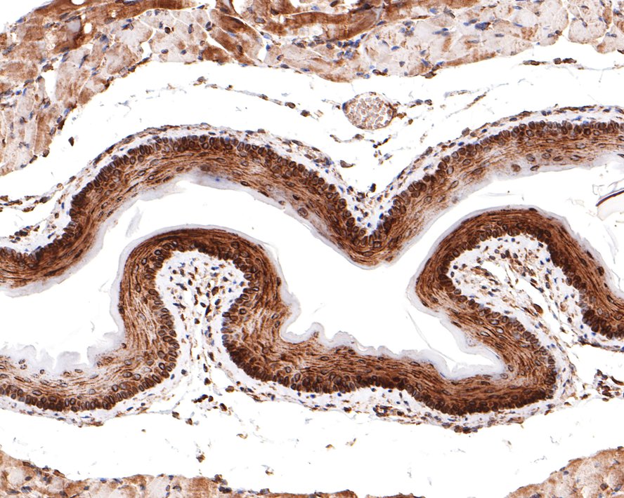 Immunohistochemical analysis of paraffin-embedded mouse esophagus tissue with Rabbit anti-TMEM43 antibody (HA721083) at 1/100 dilution.<br />
<br />
The section was pre-treated using heat mediated antigen retrieval with sodium citrate buffer (pH 6.0) for 2 minutes. The tissues were blocked in 1% BSA for 20 minutes at room temperature, washed with ddH2O and PBS, and then probed with the primary antibody (HA721083) at 1/100 dilution for 1 hour at room temperature. The detection was performed using an HRP conjugated compact polymer system. DAB was used as the chromogen. Tissues were counterstained with hematoxylin and mounted with DPX.
