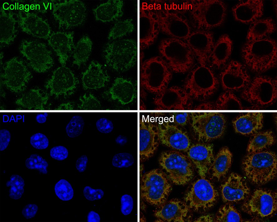 Immunocytochemistry analysis of Hela cells labeling Collagen VI with Rabbit anti-Collagen VI antibody (HA720155F) at 1/100 dilution.<br />
<br />
Cells were fixed in 4% paraformaldehyde for 10 minutes, permeabilized with 0.1% Triton X-100 in PBS for 15 minutes, and then blocked with 2% normal goat serum for 1 hour at 37 ℃. Cells were then incubated with Rabbit anti-Collagen VI antibody (HA720155F) at 1/100 dilution in 2% normal goat serum overnight at 4 ℃. Nuclear DNA was labelled in blue with DAPI.<br />
<br />
Beta tubulin (M1305-2, red) was stained at 1/200 dilution overnight at +4℃. Goat Anti-Mouse IgG H&L (iFluor™ 594, HA1126) were used as the secondary antibody at 1/800 dilution.