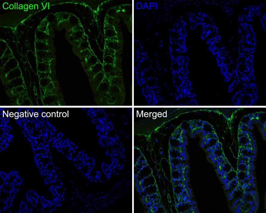 Immunofluorescence analysis of paraffin-embedded mouse colon tissue labeling Collagen VI (HA720155F).<br />
<br />
The section was pre-treated using heat mediated antigen retrieval with Tris-EDTA buffer (pH 9.0) for 20 minutes. The tissues were blocked in 10% negative goat serum for 1 hour at room temperature, washed with PBS. And then probed with the primary antibody Collagen VI (HA720155F, iFluor™ 488) at 1/50 dilution overnight at 4 ℃, washed with PBS. DAPI was used as nuclear counterstain.