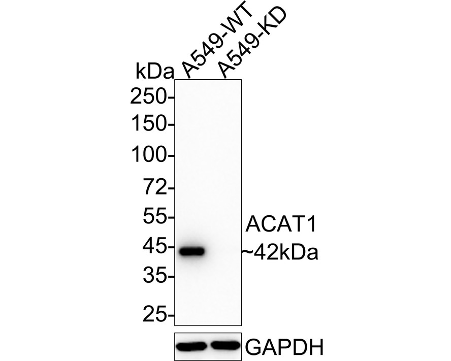 Western blot analysis of ACAT1 on different lysates with Rabbit anti-ACAT1 antibody (HA721093) at 1/500 dilution.<br />
<br />
Lane 1: Raji cell lysate<br />
Lane 2: HepG2 cell lysate<br />
<br />
Lysates/proteins at 10 µg/Lane.<br />
<br />
Predicted band size: 45 kDa<br />
Observed band size: 42 kDa<br />
<br />
Exposure time: 4 minutes;<br />
<br />
12% SDS-PAGE gel.<br />
<br />
Proteins were transferred to a PVDF membrane and blocked with 5% NFDM/TBST for 1 hour at room temperature. The primary antibody (HA721093) at 1/500 dilution was used in 5% NFDM/TBST at room temperature for 2 hours. Goat Anti-Rabbit IgG - HRP Secondary Antibody (HA1001) at 1:200,000 dilution was used for 1 hour at room temperature.