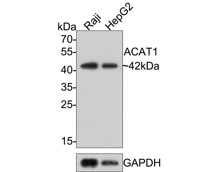 Western blot analysis of ACAT1 on different lysates with Rabbit anti-ACAT1 antibody (HA721093) at 1/500 dilution.<br />
<br />
Lane 1: Rat liver tissue lysate<br />
Lane 2: Rat heart tissue lysate<br />
<br />
Lysates/proteins at 20 µg/Lane.<br />
<br />
Predicted band size: 45 kDa<br />
Observed band size: 42 kDa<br />
<br />
Exposure time: 1 minutes;<br />
<br />
8% SDS-PAGE gel.<br />
<br />
Proteins were transferred to a PVDF membrane and blocked with 5% NFDM/TBST for 1 hour at room temperature. The primary antibody (HA721093) at 1/500 dilution was used in 5% NFDM/TBST at room temperature for 2 hours. Goat Anti-Rabbit IgG - HRP Secondary Antibody (HA1001) at 1:300,000 dilution was used for 1 hour at room temperature.