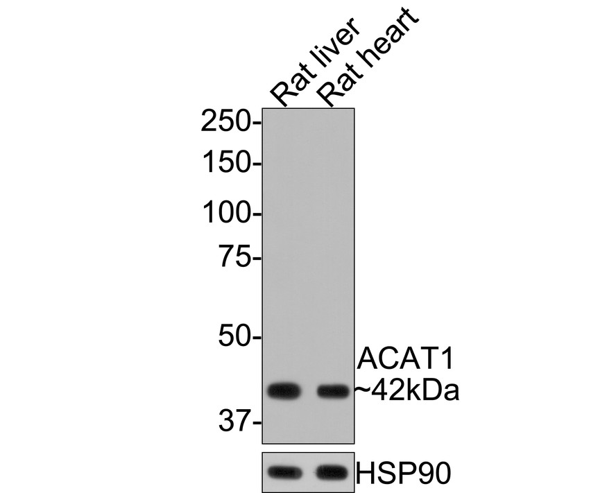 Immunocytochemistry analysis of HepG2 cells labeling ACAT1 with Rabbit anti-ACAT1 antibody (HA721093) at 1/250 dilution.<br />
<br />
Cells were fixed in 4% paraformaldehyde for 20 minutes at room temperature, permeabilized with 0.1% Triton X-100 in PBS for 5 minutes at room temperature, then blocked with 1% BSA in 10% negative goat serum for 1 hour at room temperature. Cells were then incubated with Rabbit anti-ACAT1 antibody (HA721093) at 1/250 dilution in 1% BSA in PBST overnight at 4 ℃. Goat Anti-Rabbit IgG H&L (iFluor™ 488, HA1121) was used as the secondary antibody at 1/1,000 dilution. PBS instead of the primary antibody was used as the secondary antibody only control. Counterstained with Mitotracker. Nuclear DNA was labelled in blue with DAPI.