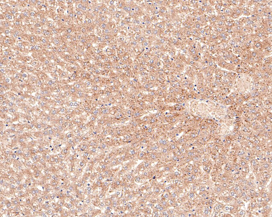 Immunohistochemical analysis of paraffin-embedded mouse liver tissue with Rabbit anti-ACAT1 antibody (HA721093) at 1/100 dilution.<br />
<br />
The section was pre-treated using heat mediated antigen retrieval with Tris-EDTA buffer (pH 9.0) for 20 minutes. The tissues were blocked in 1% BSA for 20 minutes at room temperature, washed with ddH2O and PBS, and then probed with the primary antibody (HA721093) at 1/100 dilution for 1 hour at room temperature. The detection was performed using an HRP conjugated compact polymer system. DAB was used as the chromogen. Tissues were counterstained with hematoxylin and mounted with DPX.