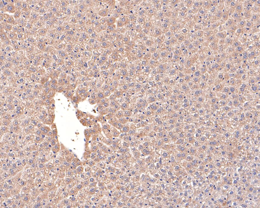 Immunohistochemical analysis of paraffin-embedded mouse heart tissue with Rabbit anti-ACAT1 antibody (HA721093) at 1/400 dilution.<br />
<br />
The section was pre-treated using heat mediated antigen retrieval with Tris-EDTA buffer (pH 9.0) for 20 minutes. The tissues were blocked in 1% BSA for 20 minutes at room temperature, washed with ddH2O and PBS, and then probed with the primary antibody (HA721093) at 1/400 dilution for 1 hour at room temperature. The detection was performed using an HRP conjugated compact polymer system. DAB was used as the chromogen. Tissues were counterstained with hematoxylin and mounted with DPX.