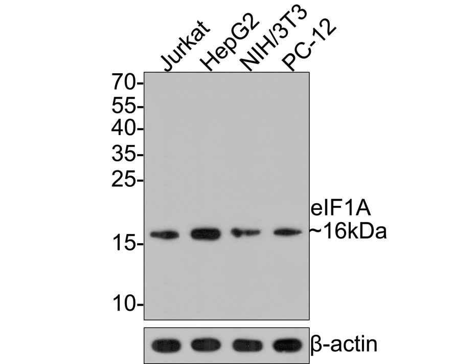 Western blot analysis of eIF1A on different lysates with Rabbit anti-eIF1A antibody (HA721099) at 1/500 dilution.<br />
<br />
Lane 1: Jurkat cell lysate<br />
Lane 2: HepG2 cell lysate<br />
Lane 3: NIH/3T3 cell lysate <br />
Lane 4: PC-12 cell lysate  <br />
<br />
Lysates/proteins at 10 µg/Lane.<br />
<br />
Predicted band size: 16 kDa<br />
Observed band size: 16 kDa<br />
<br />
Exposure time: 2 minutes;<br />
<br />
15% SDS-PAGE gel.<br />
<br />
Proteins were transferred to a PVDF membrane and blocked with 5% NFDM/TBST for 1 hour at room temperature. The primary antibody (HA721099) at 1/500 dilution was used in 5% NFDM/TBST at room temperature for 2 hours. Goat Anti-Rabbit IgG - HRP Secondary Antibody (HA1001) at 1:300,000 dilution was used for 1 hour at room temperature."