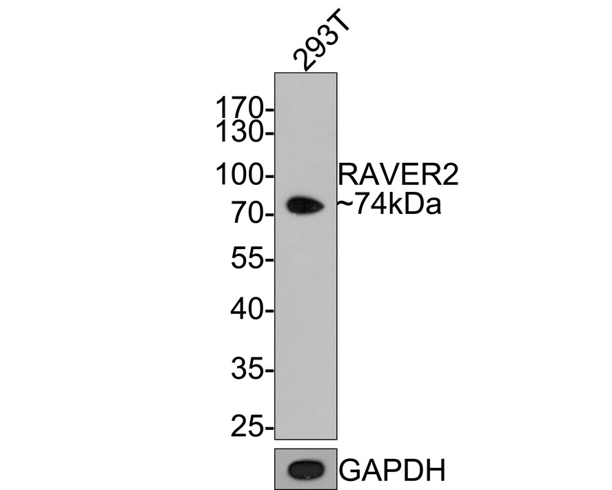 Western blot analysis of RAVER2 on 293T cell lysates with Rabbit anti-RAVER2 antibody (HA721100) at 1/1,000 dilution.<br />
<br />
Lysates/proteins at 10 µg/Lane.2<br />
<br />
Predicted band size: 74 kDa<br />
Observed band size: 74 kDa<br />
<br />
Exposure time: 2 minutes;<br />
<br />
10% SDS-PAGE gel.<br />
<br />
Proteins were transferred to a PVDF membrane and blocked with 5% NFDM/TBST for 1 hour at room temperature. The primary antibody (HA721100) at 1/1,000 dilution was used in 5% NFDM/TBST at room temperature for 2 hours. Goat Anti-Rabbit IgG - HRP Secondary Antibody (HA1001) at 1:200,000 dilution was used for 1 hour at room temperature.