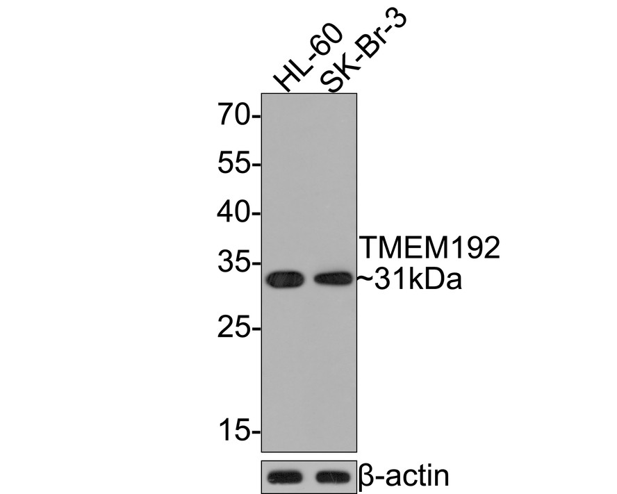 Western blot analysis of TMEM192 on different lysates with Rabbit anti-TMEM192 antibody (HA721106) at 1/500 dilution.<br />
<br />
Lane 1: HL-60 cell lysate<br />
Lane 2: SK-Br-3 cell lysate<br />
<br />
Lysates/proteins at 10 µg/Lane.<br />
<br />
Predicted band size: 31 kDa<br />
Observed band size: 31 kDa<br />
<br />
Exposure time: 2 minutes;<br />
<br />
12% SDS-PAGE gel.<br />
<br />
Proteins were transferred to a PVDF membrane and blocked with 5% NFDM/TBST for 1 hour at room temperature. The primary antibody (HA721106) at 1/500 dilution was used in 5% NFDM/TBST at room temperature for 2 hours. Goat Anti-Rabbit IgG - HRP Secondary Antibody (HA1001) at 1:300,000 dilution was used for 1 hour at room temperature.