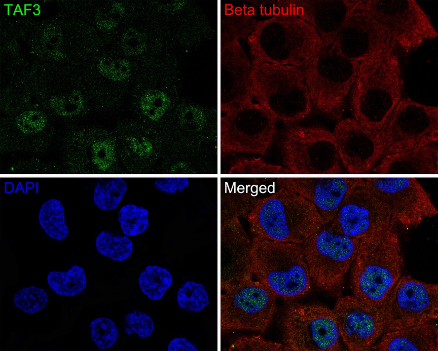 Immunocytochemistry analysis of NCI-H441 cells labeling TAF3 with Rabbit anti-TAF3 antibody (HA721107) at 1/50 dilution.<br />
<br />
Cells were fixed in 4% paraformaldehyde for 10 minutes at 37 ℃, permeabilized with 0.05% Triton X-100 in PBS for 20 minutes, and then blocked with 2% negative goat serum for 30 minutes at room temperature. Cells were then incubated with Rabbit anti-TAF3 antibody (HA721107) at 1/50 dilution in 2% negative goat serum overnight at 4 ℃. Goat Anti-Rabbit IgG H&L (Alexa Fluor® 488) was used as the secondary antibody at 1/1,000 dilution. Nuclear DNA was labelled in blue with DAPI.<br />
<br />
Beta tubulin (M1305-2, red) was stained at 1/200 dilution overnight at +4℃. Goat Anti-Mouse IgG H&L (iFluor™ 647, HA1127) were used as the secondary antibody at 1/1,000 dilution.