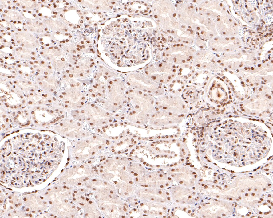Immunohistochemical analysis of paraffin-embedded human kidney tissue with Rabbit anti-NTH1 antibody (HA721108) at 1/400 dilution.<br />
<br />
The section was pre-treated using heat mediated antigen retrieval with sodium citrate buffer (pH 6.0) for 2 minutes. The tissues were blocked in 1% BSA for 20 minutes at room temperature, washed with ddH2O and PBS, and then probed with the primary antibody (HA721108) at 1/400 dilution for 1 hour at room temperature. The detection was performed using an HRP conjugated compact polymer system. DAB was used as the chromogen. Tissues were counterstained with hematoxylin and mounted with DPX.