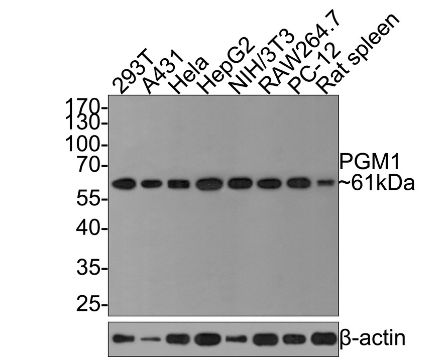Western blot analysis of PGM1 on different lysates with Rabbit anti-PGM1 antibody (HA721110) at 1/500 dilution.<br />
<br />
Lane 1: 293T cell lysate, 10 µg/Lane<br />
Lane 2: A431 cell lysate, 10 µg/Lane<br />
Lane 3: Hela cell lysate, 10 µg/Lane<br />
Lane 4: HepG2 cell lysate, 10 µg/Lane<br />
Lane 5: NIH/3T3 cell lysate, 10 µg/Lane<br />
Lane 6: RAW264.7 cell lysate, 10 µg/Lane<br />
Lane 7: PC-12 cell lysate, 10 µg/Lane<br />
Lane 8: Rat spleen tissue lysate, 20 µg/Lane<br />
<br />
Predicted band size: 61 kDa<br />
Observed band size: 61 kDa<br />
<br />
Exposure time: 2 minutes;<br />
<br />
10% SDS-PAGE gel.<br />
<br />
Proteins were transferred to a PVDF membrane and blocked with 5% NFDM/TBST for 1 hour at room temperature. The primary antibody (HA721110) at 1/500 dilution was used in 5% NFDM/TBST at room temperature for 2 hours. Goat Anti-Rabbit IgG - HRP Secondary Antibody (HA1001) at 1:300,000 dilution was used for 1 hour at room temperature.