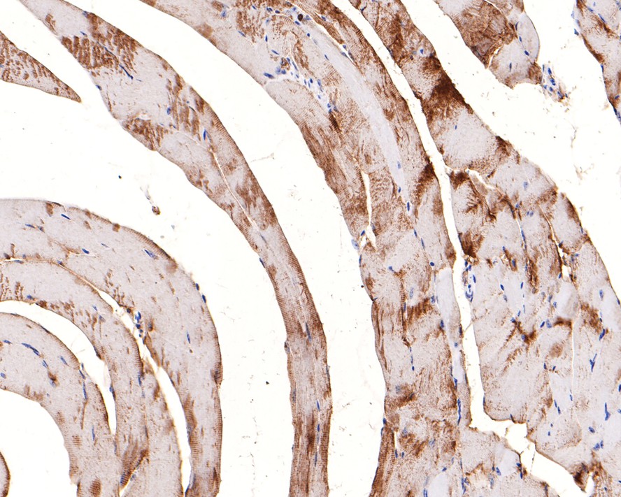 Immunohistochemical analysis of paraffin-embedded mouse skeletal muscle tissue with Rabbit anti-PGM1 antibody (HA721110) at 1/100 dilution.<br />
<br />
The section was pre-treated using heat mediated antigen retrieval with Tris-EDTA buffer (pH 9.0) for 20 minutes. The tissues were blocked in 1% BSA for 20 minutes at room temperature, washed with ddH2O and PBS, and then probed with the primary antibody (HA721110) at 1/100 dilution for 1 hour at room temperature. The detection was performed using an HRP conjugated compact polymer system. DAB was used as the chromogen. Tissues were counterstained with hematoxylin and mounted with DPX.