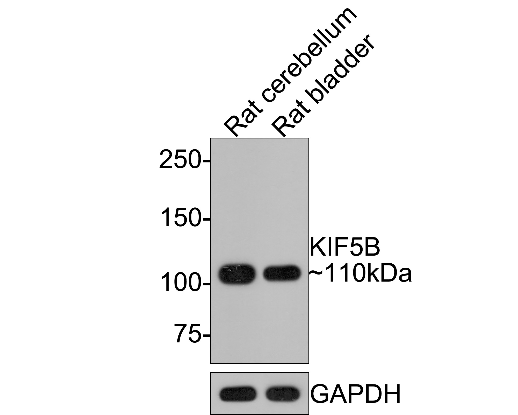 Western blot analysis of KIF5B on different lysates with Rabbit anti-KIF5B antibody (HA721045) at 1/500 dilution.<br />
<br />
Lane 1: Rat cerebellum tissue lysate<br />
Lane 2: Rat bladder tissue lysate<br />
<br />
Lysates/proteins at 20 µg/Lane.<br />
<br />
Predicted band size: 110 kDa<br />
Observed band size: 110 kDa<br />
<br />
Exposure time: 1 minute;<br />
<br />
6% SDS-PAGE gel.<br />
<br />
Proteins were transferred to a PVDF membrane and blocked with 5% NFDM/TBST for 1 hour at room temperature. The primary antibody (HA721045) at 1/500 dilution was used in 5% NFDM/TBST at room temperature for 2 hours. Goat Anti-Rabbit IgG - HRP Secondary Antibody (HA1001) at 1:300,000 dilution was used for 1 hour at room temperature.
