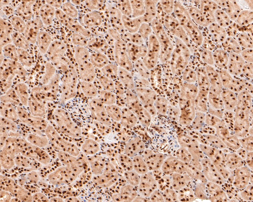 Immunohistochemical analysis of paraffin-embedded rat kidney tissue with Rabbit anti-TCEA1 antibody (HA721086) at 1/2,000 dilution.<br />
<br />
The section was pre-treated using heat mediated antigen retrieval with sodium citrate buffer (pH 6.0) for 2 minutes. The tissues were blocked in 1% BSA for 20 minutes at room temperature, washed with ddH2O and PBS, and then probed with the primary antibody (HA721086) at 1/2,000 dilution for 1 hour at room temperature. The detection was performed using an HRP conjugated compact polymer system. DAB was used as the chromogen. Tissues were counterstained with hematoxylin and mounted with DPX.