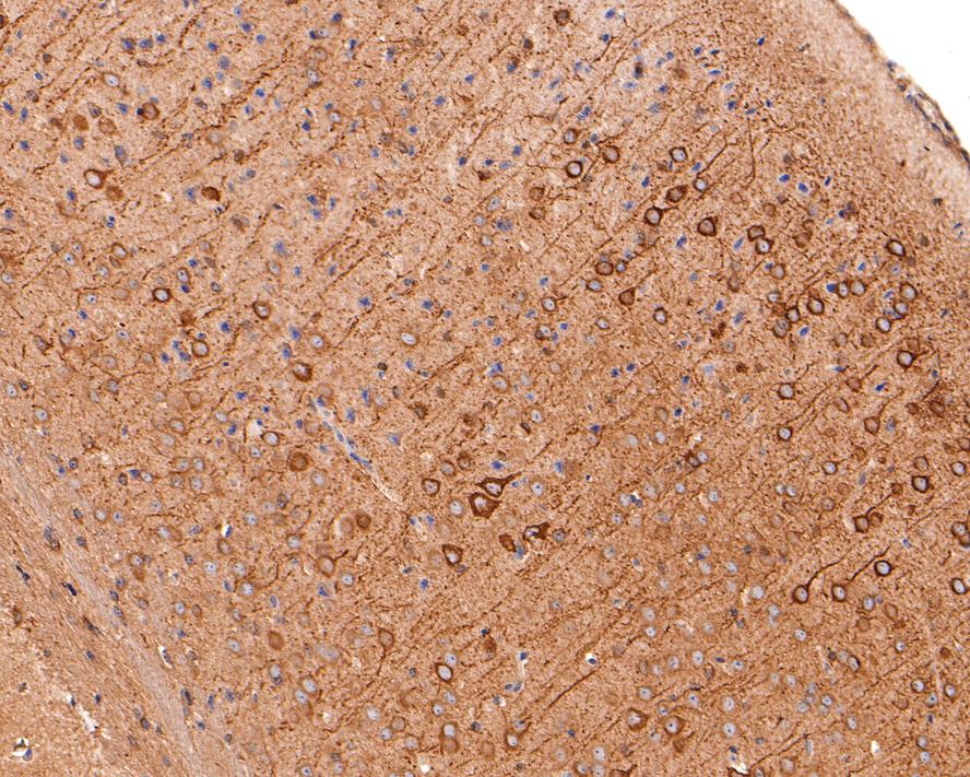 Immunohistochemical analysis of paraffin-embedded mouse brain tissue with Rabbit anti-TPMT antibody (HA721049) at 1/1,000 dilution.<br />
<br />
The section was pre-treated using heat mediated antigen retrieval with Tris-EDTA buffer (pH 9.0) for 20 minutes. The tissues were blocked in 1% BSA for 20 minutes at room temperature, washed with ddH2O and PBS, and then probed with the primary antibody (HA721049) at 1/1,000 dilution for 1 hour at room temperature. The detection was performed using an HRP conjugated compact polymer system. DAB was used as the chromogen. Tissues were counterstained with hematoxylin and mounted with DPX.