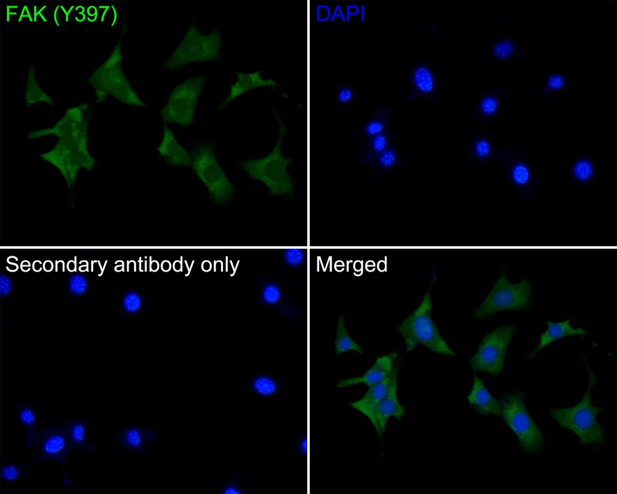Immunocytochemistry analysis of NIH/3T3 cells labeling Phospho-FAK (Y397) with Rabbit anti-Phospho-FAK (Y397) antibody (ET1610-34) at 1/100 dilution.<br />
<br />
Cells were fixed in 4% paraformaldehyde for 10 minutes at 37 ℃, permeabilized with 0.05% Triton X-100 in PBS for 20 minutes, and then blocked with 2% negative goat serum for 30 minutes at room temperature. Cells were then incubated with Rabbit anti-Phospho-FAK (Y397) antibody (ET1610-34) at 1/100 dilution in 2% negative goat serum overnight at 4 ℃. Goat Anti-Rabbit IgG H&L (iFluor™ 488, HA1121) was used as the secondary antibody at 1/1,000 dilution. PBS instead of the primary antibody was used as the secondary antibody only control. Nuclear DNA was labelled in blue with DAPI.