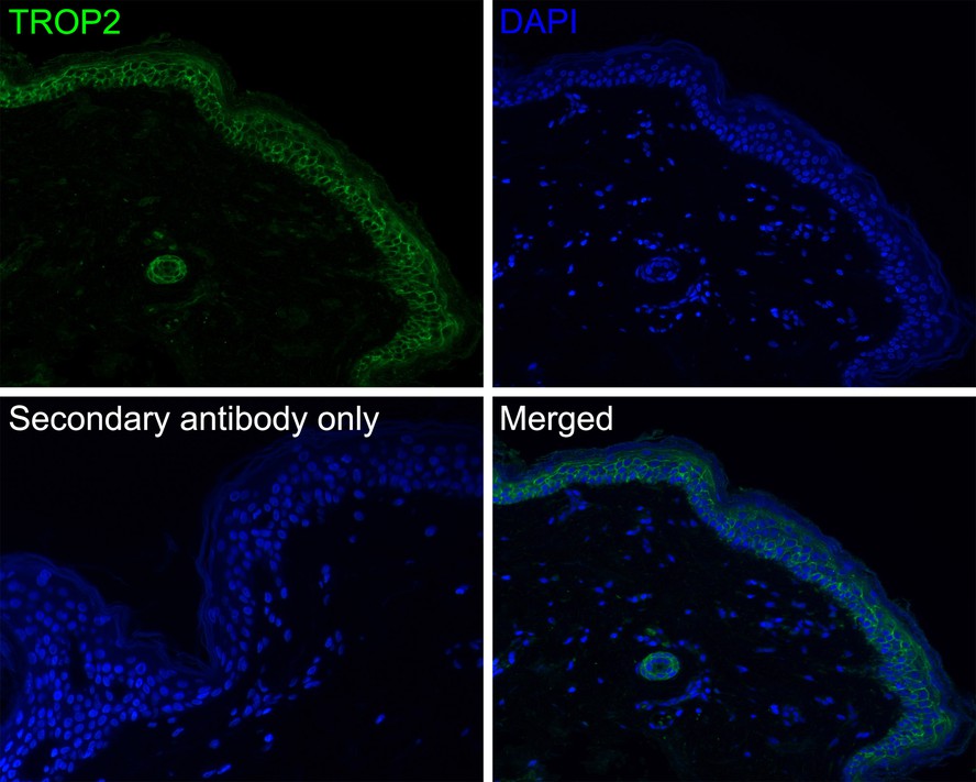 Immunofluorescence analysis of paraffin-embedded human skin tissue labeling TROP2 with Rabbit anti-TROP2 antibody (ER1802-60) at 1/85 dilution.<br />
<br />
The section was pre-treated using heat mediated antigen retrieval with Tris-EDTA buffer (pH 9.0) for 20 minutes. The tissues were blocked in 10% negative goat serum for 1 hour at room temperature, washed with PBS, and then probed with the primary antibody (ER1802-60, red) at 1/85 dilution overnight at 4 ℃, washed with PBS.<br />
<br />
Goat Anti-Rabbit IgG H&L (iFluor™ 488, HA1121) was used as the secondary antibody at 1/1,000 dilution. Nuclei were counterstained with DAPI (blue).