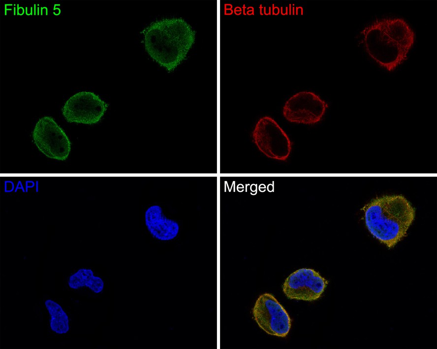 Immunocytochemistry analysis of Hela  cells labeling Fibulin 5 with Rabbit anti-Fibulin 5 antibody (ER1802-95) at 1/100 dilution.<br />
<br />
Cells were fixed in 4% paraformaldehyde for 10 minutes at 37 ℃, permeabilized with 0.05% Triton X-100 in PBS for 20 minutes, and then blocked with 2% negative goat serum for 30 minutes at room temperature. Cells were then incubated with Rabbit anti-Fibulin 5 antibody (ER1802-95) at 1/100 dilution in 2% negative goat serum overnight at 4 ℃. Goat Anti-Rabbit IgG H&L (Alexa Fluor® 488) was used as the secondary antibody at 1/1,000 dilution. Nuclear DNA was labelled in blue with DAPI.<br />
<br />
Beta tubulin (M1305-2, red) was stained at 1/200 dilution overnight at +4℃. Goat Anti-Mouse IgG H&L (Alexa Fluor® 647) were used as the secondary antibody at 1/1,000 dilution.