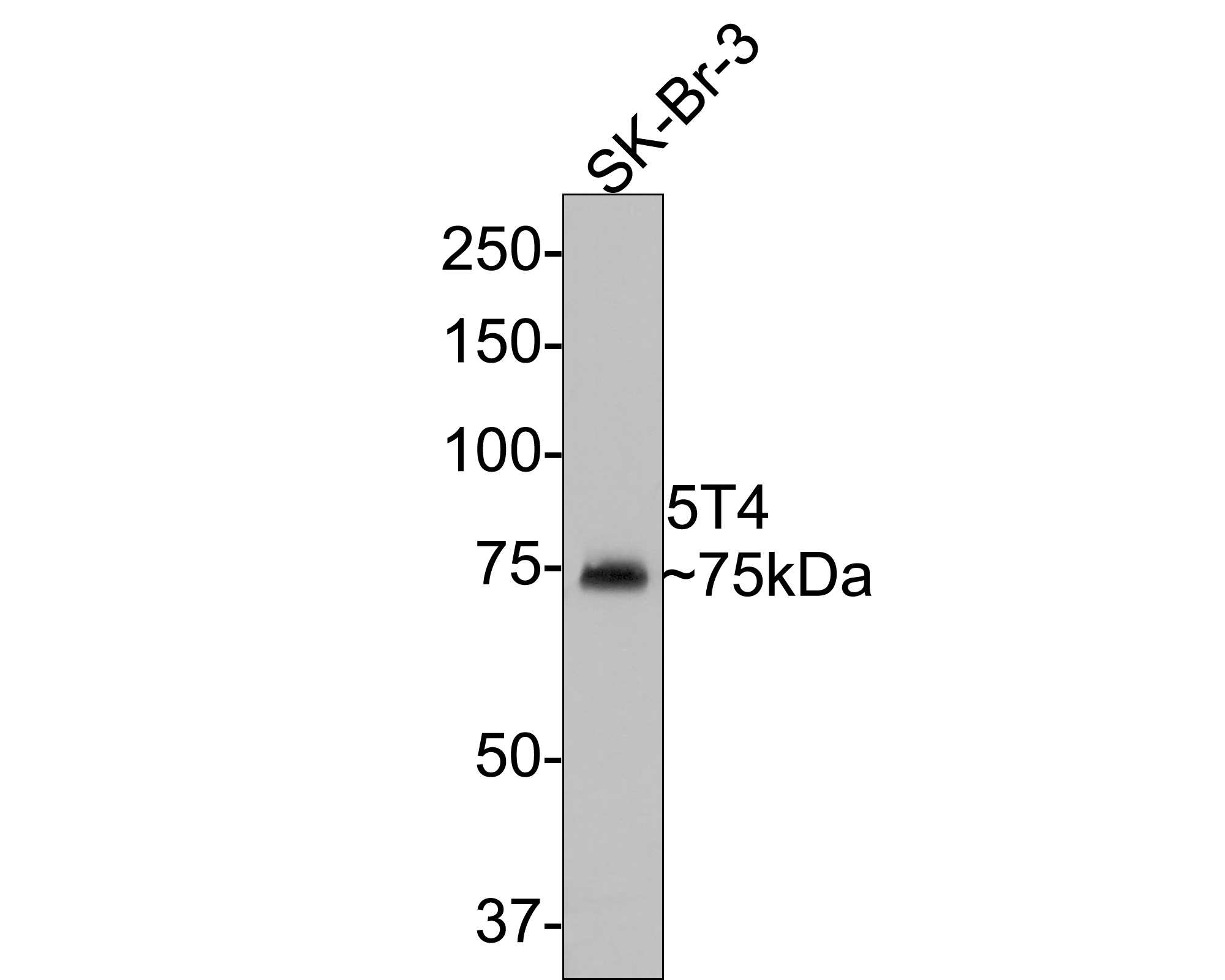Western blot analysis of 5T4 on SK-Br-3 cell lysates with Rabbit anti-5T4 antibody (ET1608-37) at 1/500 dilution.<br />
<br />
Lysates/proteins at 10 µg/Lane.<br />
<br />
Predicted band size: 46 kDa<br />
Observed band size: 75 kDa<br />
<br />
Exposure time: 2 minutes;<br />
<br />
8% SDS-PAGE gel.<br />
<br />
Proteins were transferred to a PVDF membrane and blocked with 5% NFDM/TBST for 1 hour at room temperature. The primary antibody (ET1608-37) at 1/500 dilution was used in 5% NFDM/TBST at room temperature for 2 hours. Goat Anti-Rabbit IgG - HRP Secondary Antibody (HA1001) at 1:300,000 dilution was used for 1 hour at room temperature.